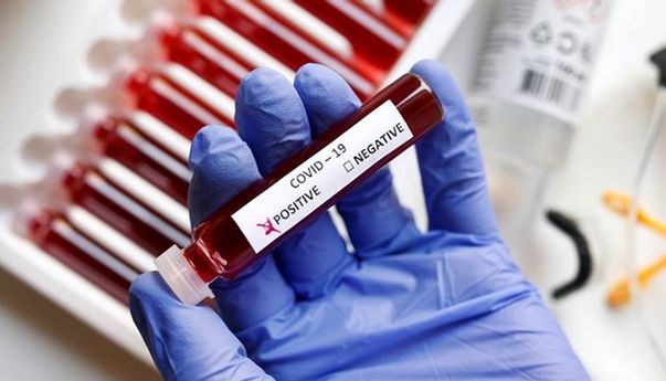 Dalam Dua Hari, Magelang Catat Tambahan 31 Pasien Covid-19