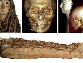 Setelah 140 Tahun Akhirnya Ilmuwan Berhasil Bedah Mumi Amenhotep I, Tanpa Rusak Topeng dan Perban