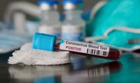 Berita Jogja: Satu Orang ASN di Dinas Kesehatan DIY Meninggal Akibat Covid-19 Punya Riwayat Diabetes
