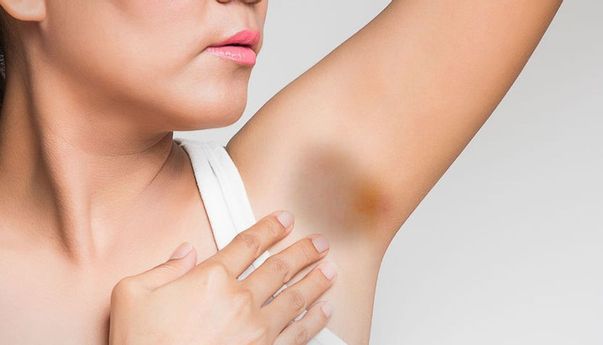 Gunakan Bahan Ini untuk Mencerahkan Ketiak