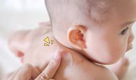 Mom, Ini Cara Atasi Kulit Bayi yang Hitam Karena Gigitan Nyamuk