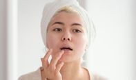 Alami Jerawat di Bibir? Ketahui Kenyebab dan dan Cara Mencegahnya