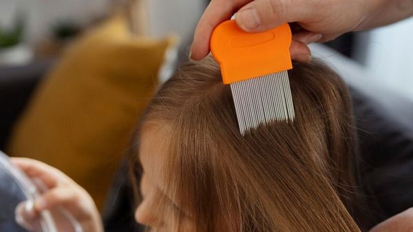 Tak Perlu Lama, 4 Cara Efektif Hilangkan Kutu Rambut dalam Satu Hari