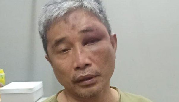 Begini Tanggapan Chandra Soal Muhammad Kece Dihajar Hingga Babak Belur oleh Irjen Napoleon
