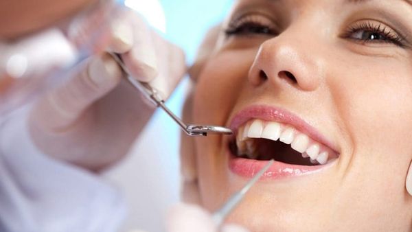 Cara Menghilangkan Karang Gigi yang Manjur