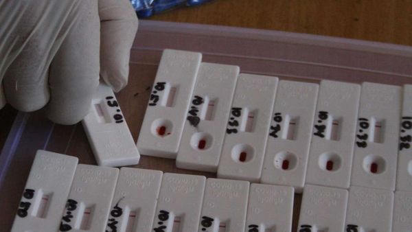 Sebentar Lagi Alat Rapid Test Kimia Farma Dirilis, Harganya di Bawah Rp100 Ribuan