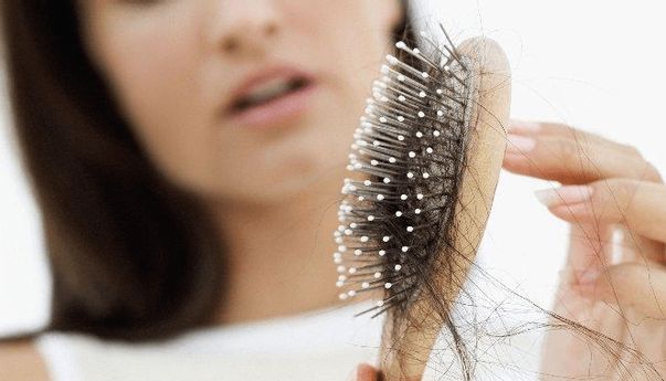 Kata Dokter Soal Perbedaan Pola Rambut Rontok Pada Pria dan Wanita