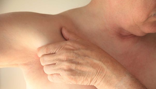 Ini Daftar Obat Bisul Alami yang Bisa Bantu Proses Penyembuhan Lebih Cepat