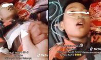 Viral! Bocah SD Alami Koma Setelah Dikeroyok Kakak Kelas, Kini Harus Pakai Selang Oksigen