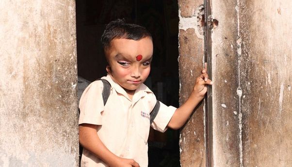 Bocah yang Terlahir dengan Kelainan Fisik Ini Dipuja, Dianggap Titisan Dewa Ganesha