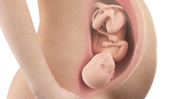 Pengapuran Plasenta Dini pada Ibu Hamil, Apa Saja Gejalanya?