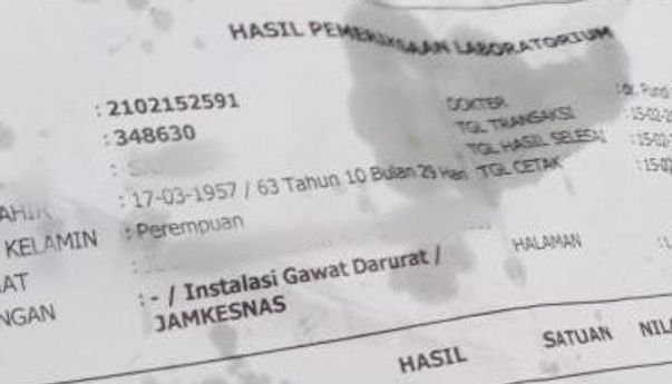 Viral Kertas Hasil Tes PCR Positif COVID-19 Jadi Bungkus Gorengan, Begini Tanggapan Kemenkes