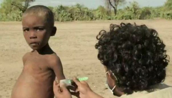 Warga Madagaskar Hadapi Bencana Kelaparan, Terpaksa Makan Belalang dan Daun Liar Demi Bertahan Hidup