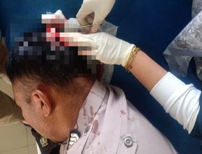 Kena Bacok: Dua Polisi Diserang Orang Gangguan Jiwa di Aceh