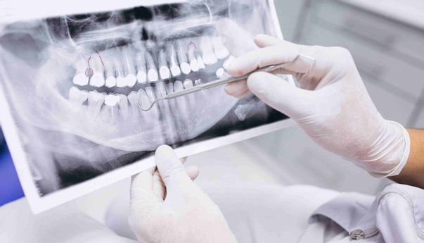 Waspada! Inilah Minuman yang Menjadi Penyebab Kanker Mulut