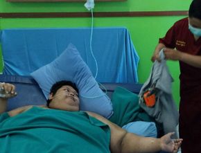 Pemuda Obesitas 300 Kg Meninggal Dunia di RSCM