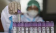 Para Ahli Memprediksi Virus Corona B117 Telah Menyebar di Indonesia Sejak 2020