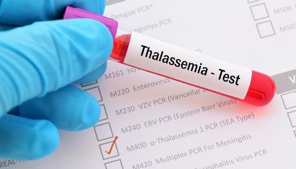 Penderita Thalasemia di Indonesia Tembus 10 Ribu