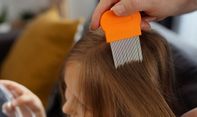Tak Perlu Lama, 4 Cara Efektif Hilangkan Kutu Rambut dalam Satu Hari