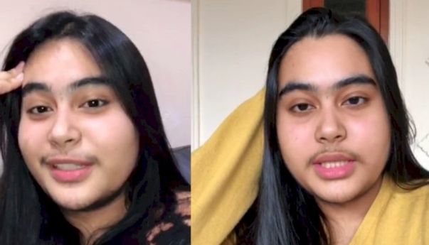 Viral Wanita Cantik Berkumis dan Berjenggot Bagikan Tips Agar Tidak Insecure