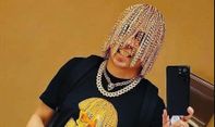 Ekstrem! Rapper Ini Tanam Rantai Emas di Kepala untuk Gantikan Rambutnya