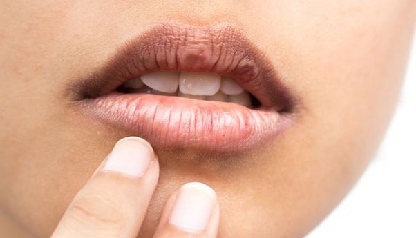 Kebiasaan Penyebab Bibir Hitam Tanpa Disadari