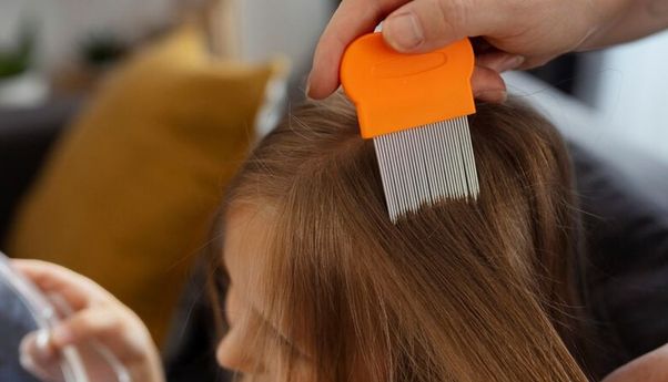 Tak Perlu Lama, 4 Cara Efektif Hilangkan Kutu Rambut dalam Satu Hari