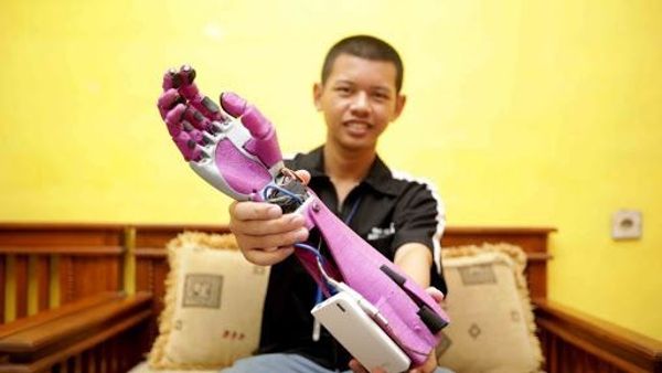 Anak SMK di Tasikmalaya Berhasil Ciptakan Tangan Robot Khusus Disabilitas