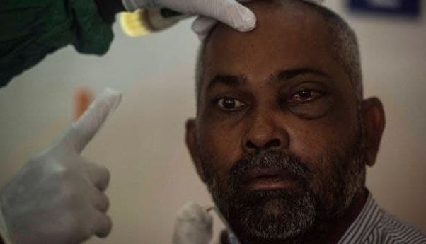 Jamur Hitam Tewaskan Ribuan Orang di India, Ternyata Sudah Ada di Indonesia Bahkan Sebelum Pandemi