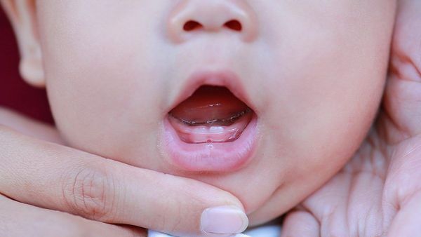 Bayi Tumbuh Gigi Suka Gigit Payudara saat Menyusu, Benarkah?