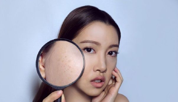 Mengatasi Flek Hitam di Wajah, Begini Caranya!
