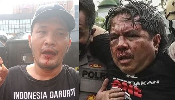 Ade Armando Hampir Dibunuh Kadrun Bersorak, Giliran Nicho Silalahi Giginya Rontok Satu Kadrun Marah, Chusnul: Otak Terbalik