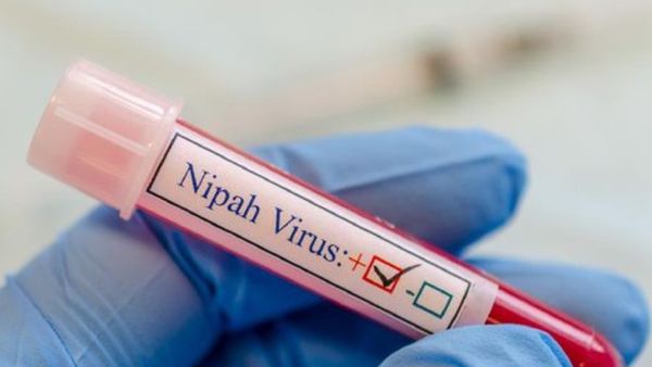 Apakah Kemunculan Virus Nipah Sebagai Pendatang Baru akan Gantikan Pandemi Setelah Covid-19?