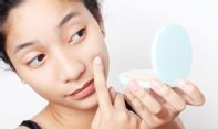 Bahaya Kebiasaan Memencet Jerawat yang Jarang Disadari Perempuan