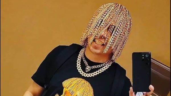 Ekstrem! Rapper Ini Tanam Rantai Emas di Kepala untuk Gantikan Rambutnya