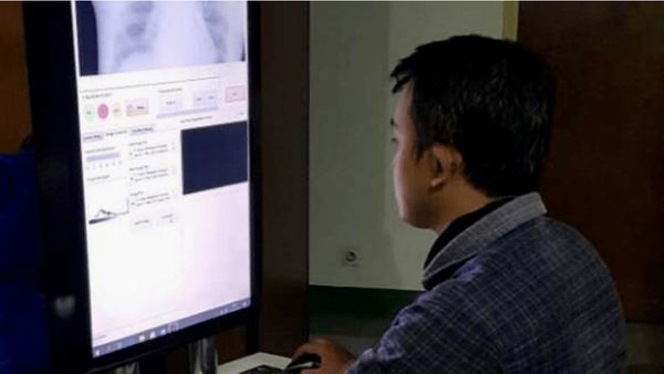 Berita Seputar Jogja: Peniliti UGM Berhasil Kembangkan Alat Deteksi Covid-19