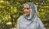 Kerap Tak PD, Irish Bella Cabut Gigi Gingsul