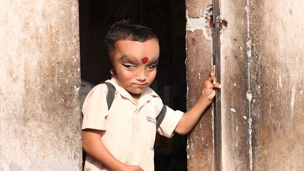 Bocah yang Terlahir dengan Kelainan Fisik Ini Dipuja, Dianggap Titisan Dewa Ganesha