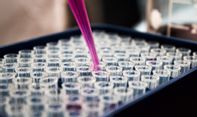 Kabar Gembira, Uji Klinis Vaksin HIV Digelar di Oxford