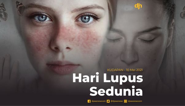 Hari Lupus Sedunia