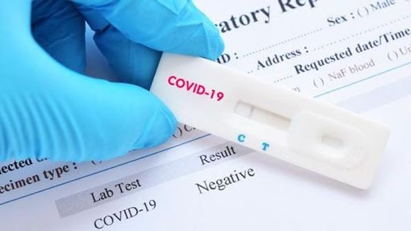 Berita Terbaru: Tidak Ada Kasus Positif Covid-19 dari Rapid Test Acak Warga Yogyakarta