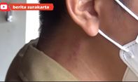 Leher Gibran Rakabuming Merah-merah karena Mbak Selvi