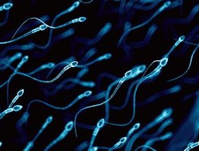 Warna Sperma Bisa Jelaskan Kondisi Kesehatan, Seperti Apa?