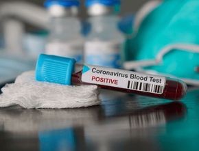 Golongan Darah O Lebih Resisten Terhadap Virus Corona, Ini Faktanya