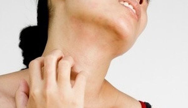 Inilah Tanda-tanda Skin Barrier Rusak, Wajah Menjadi Lebih Sensitif!