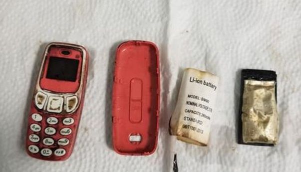 Lelaki Ini Jalani Operasi untuk Keluarkan Ponsel yang Ditelan Tanpa Alasan Jelas