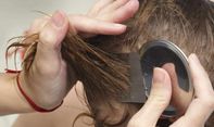 Ini Cara Menghilangkan Kutu Rambut Beserta Telurnya