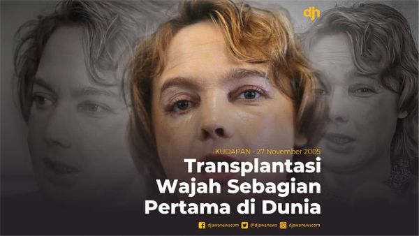 Transplantasi Wajah Sebagian Pertama di Dunia
