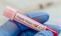 Apakah Kemunculan Virus Nipah Sebagai Pendatang Baru akan Gantikan Pandemi Setelah Covid-19?