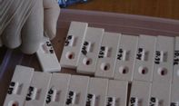 Sebentar Lagi Alat Rapid Test Kimia Farma Dirilis, Harganya di Bawah Rp100 Ribuan